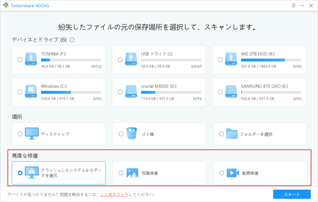 高度な復元